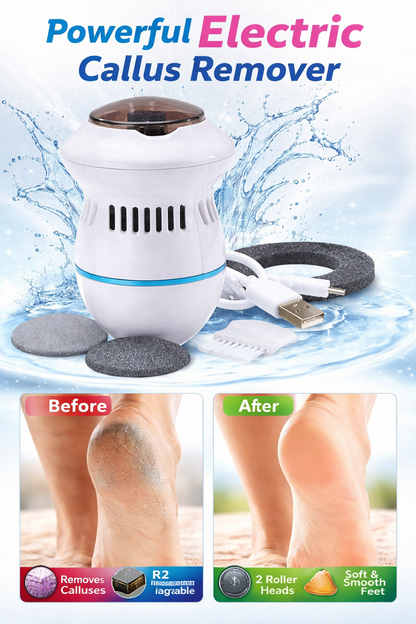 Electric Callus Remover for Feet – Rechargeable Foot File with 2 Roller Heads | Remove Hard Skin & Cracked Heels Instantly