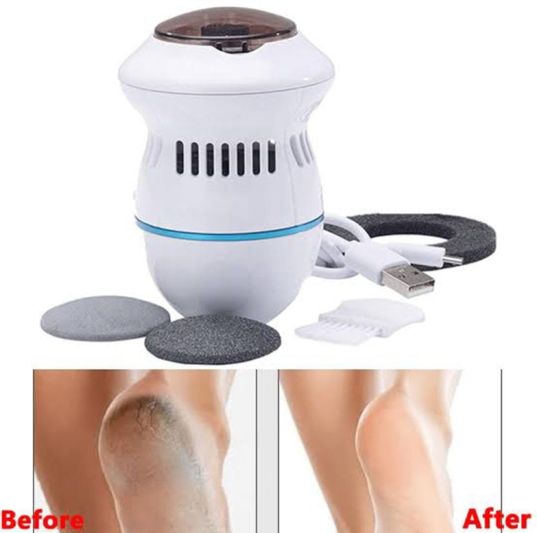 Electric Callus Remover for Feet – Rechargeable Foot File with 2 Roller Heads | Remove Hard Skin & Cracked Heels Instantly